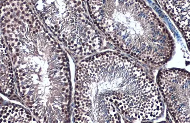 Anti-Topoisomerase II beta antibody [C3], C-term used in IHC (Paraffin sections) (IHC-P). GTX102640