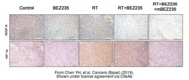 Anti-VEGFA antibody used in Immunohistochemistry (IHC). GTX102643