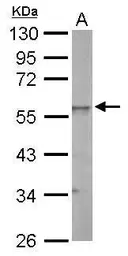 Anti-ERR gamma antibody used in Western Blot (WB). GTX102664
