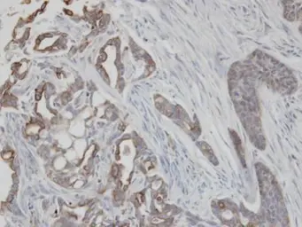Anti-Cytokeratin 2 antibody [N2C2], Internal used in IHC (Paraffin sections) (IHC-P). GTX102758