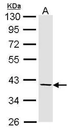 Anti-Fibromodulin antibody used in Western Blot (WB). GTX102783