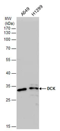 Anti-DCK antibody used in Western Blot (WB). GTX102800