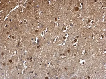 Anti-DCK antibody used in IHC (Paraffin sections) (IHC-P). GTX102800