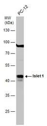 Anti-Islet 1 antibody used in Western Blot (WB). GTX102807