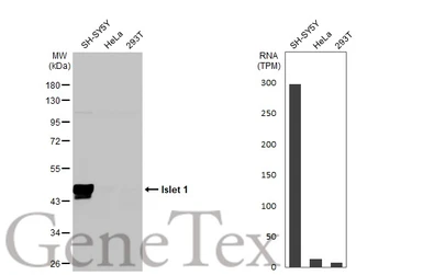 Anti-Islet 1 antibody used in Western Blot (WB). GTX102807