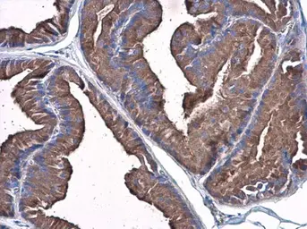 Anti-Plasminogen antibody used in IHC (Paraffin sections) (IHC-P). GTX102877