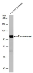 Anti-Plasminogen antibody used in Western Blot (WB). GTX102877