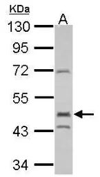 Anti-EGR2 antibody used in Western Blot (WB). GTX102912