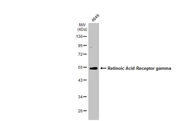 Anti-Retinoic Acid Receptor gamma antibody used in Western Blot (WB). GTX102914