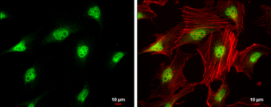 Anti-CDK4 antibody used in Immunocytochemistry/ Immunofluorescence (ICC/IF). GTX102993