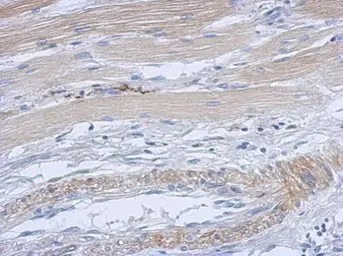 Anti-CDK4 antibody used in IHC (Paraffin sections) (IHC-P). GTX102993