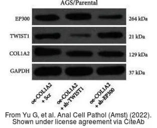Anti-COL1A2 antibody [C2C3], C-term used in Western Blot (WB). GTX102996