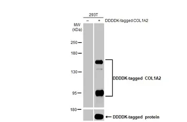 Anti-COL1A2 antibody [C2C3], C-term used in Western Blot (WB). GTX102996