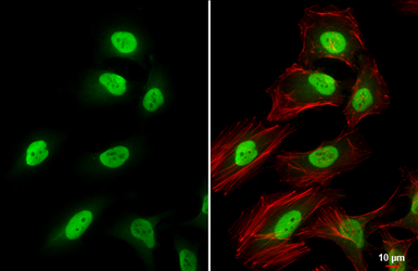 Anti-CSE1L antibody used in Immunocytochemistry/ Immunofluorescence (ICC/IF). GTX103005