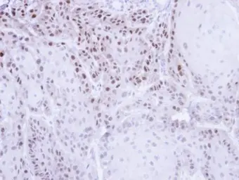 Anti-CSE1L antibody used in IHC (Paraffin sections) (IHC-P). GTX103005
