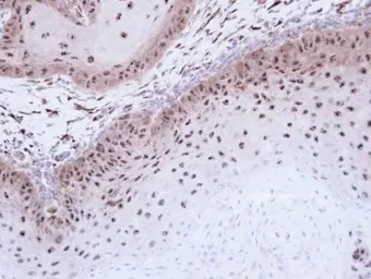 Anti-DMC1 antibody [N1C1] used in IHC (Paraffin sections) (IHC-P). GTX103062