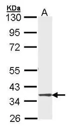 Anti-DMC1 antibody [N1C1] used in Western Blot (WB). GTX103062