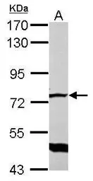Anti-GLMN antibody used in Western Blot (WB). GTX103064