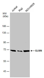 Anti-GLMN antibody used in Western Blot (WB). GTX103064