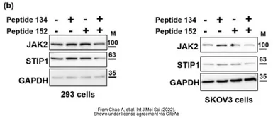 Anti-STIP1 antibody used in Western Blot (WB). GTX103068