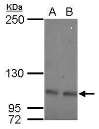 Anti-INPP5F antibody used in Western Blot (WB). GTX103107