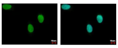 Anti-DNA ligase III antibody used in Immunocytochemistry/ Immunofluorescence (ICC/IF). GTX103172