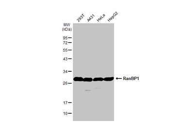 Anti-RanBP1 antibody [N1C3] used in Western Blot (WB). GTX103192