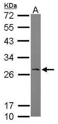 Anti-RanBP1 antibody [N1C3] used in Western Blot (WB). GTX103192