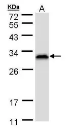 Anti-RanBP1 antibody [N1C3] used in Western Blot (WB). GTX103192