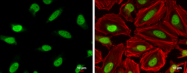 Anti-DNA ligase III antibody [C2C3], C-term used in Immunocytochemistry/ Immunofluorescence (ICC/IF). GTX103197