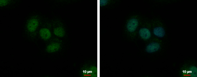 Anti-TrxR1 antibody [N1N3] used in Immunocytochemistry/ Immunofluorescence (ICC/IF). GTX103202
