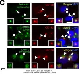 Anti-LAMP2 antibody used in Immunocytochemistry/ Immunofluorescence (ICC/IF). GTX103214