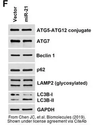 Anti-LAMP2 antibody used in Western Blot (WB). GTX103214