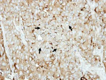 Anti-LAMP2 antibody used in IHC (Paraffin sections) (IHC-P). GTX103214