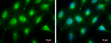 Anti-LAMP2 antibody used in Immunocytochemistry/ Immunofluorescence (ICC/IF). GTX103214