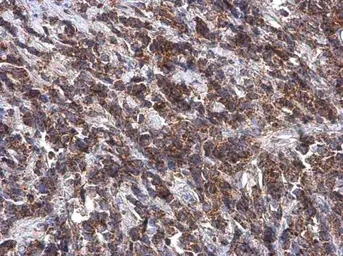 Anti-LAMP2 antibody used in IHC (Paraffin sections) (IHC-P). GTX103214