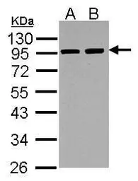 Anti-alpha Actinin 3 antibody used in Western Blot (WB). GTX103216