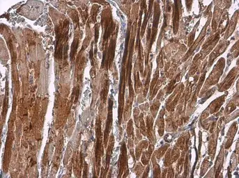 Anti-alpha Actinin 2 antibody [N1N3] used in IHC (Paraffin sections) (IHC-P). GTX103219