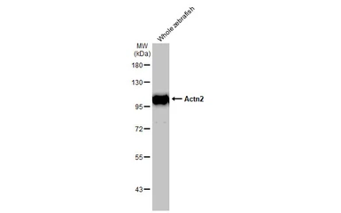 Anti-alpha Actinin 2 antibody [N1N3] used in Western Blot (WB). GTX103219