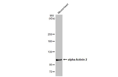 Anti-alpha Actinin 2 antibody [N1N3] used in Western Blot (WB). GTX103219