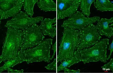 Anti-alpha Actinin 2 antibody [N1N3] used in Immunocytochemistry/ Immunofluorescence (ICC/IF). GTX103219