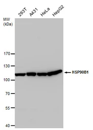 Anti-GRP94 antibody used in Western Blot (WB). GTX103232