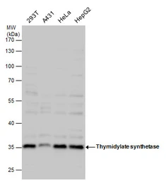 Anti-Thymidylate synthase antibody used in Western Blot (WB). GTX103235