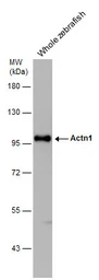 Anti-alpha Actinin 1 antibody [N2N3] used in Western Blot (WB). GTX103240