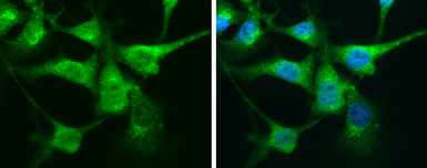 Anti-Calretinin antibody used in Immunocytochemistry/ Immunofluorescence (ICC/IF). GTX103261