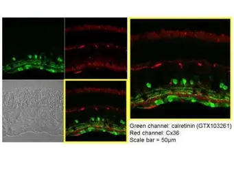Anti-Calretinin antibody used in IHC (Paraffin sections) (IHC-P). GTX103261