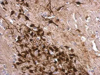 Anti-Calretinin antibody used in IHC (Paraffin sections) (IHC-P). GTX103261