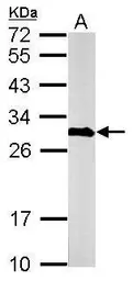 Anti-Calretinin antibody used in Western Blot (WB). GTX103261