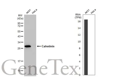 Anti-Calretinin antibody used in Western Blot (WB). GTX103261