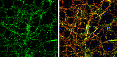 Anti-Homer1 antibody used in Immunocytochemistry/ Immunofluorescence (ICC/IF). GTX103278
